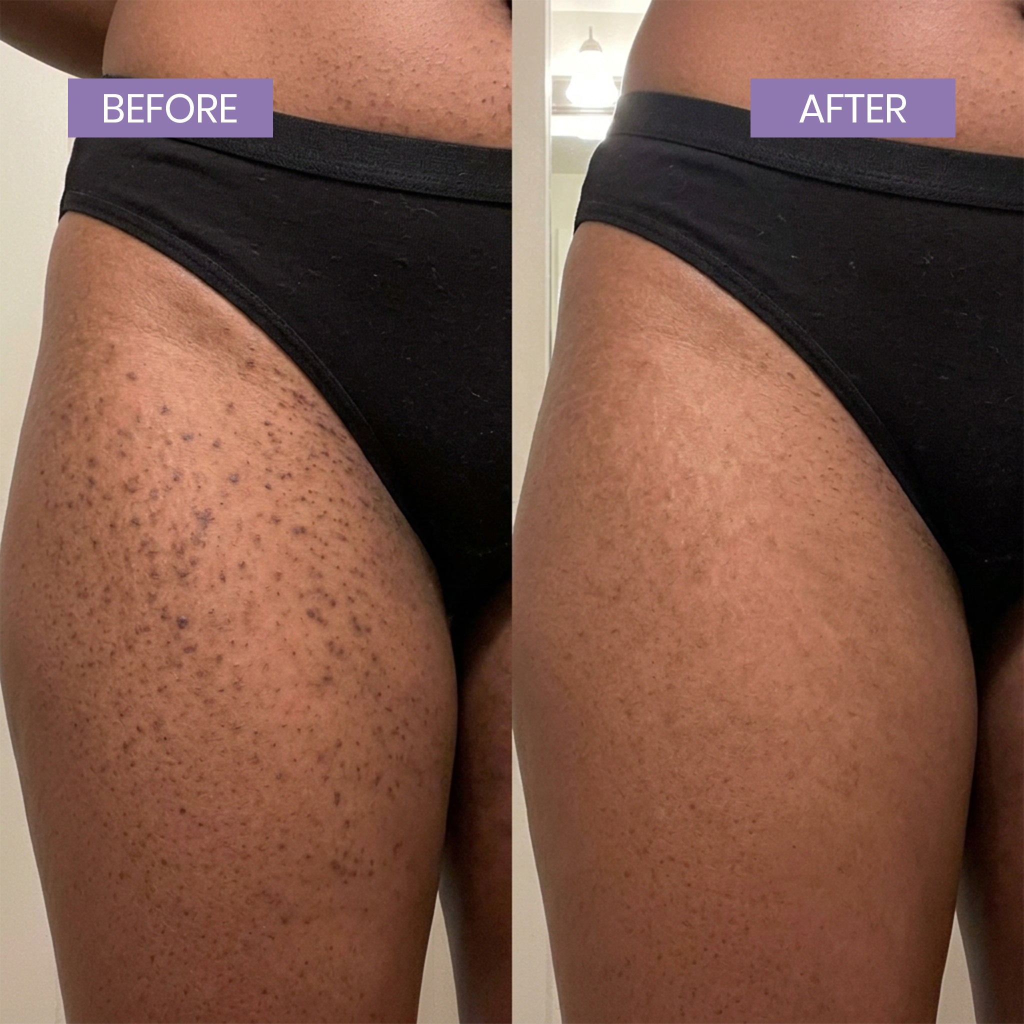 Kelle Brightening Serum