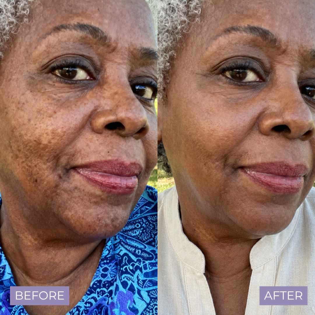Kelle Brightening Serum