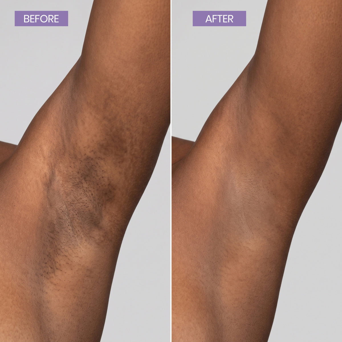 Kelle Brightening Serum