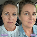 Kelle Brightening Serum