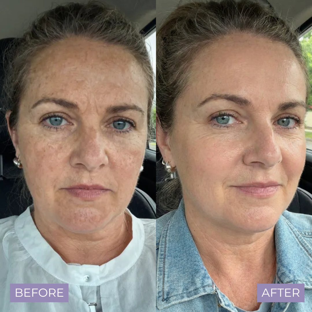 Kelle Brightening Serum