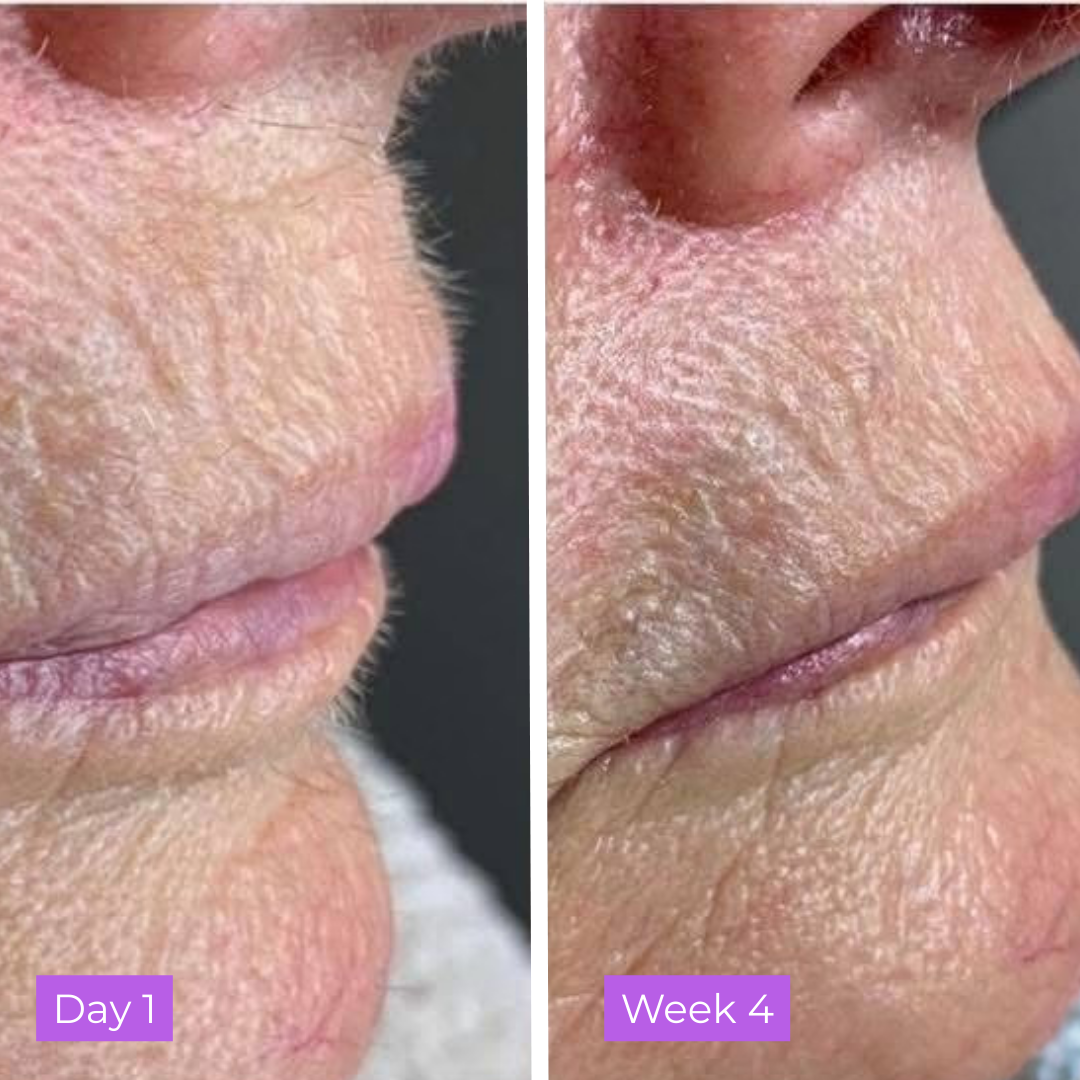 Viareline Skin Serum