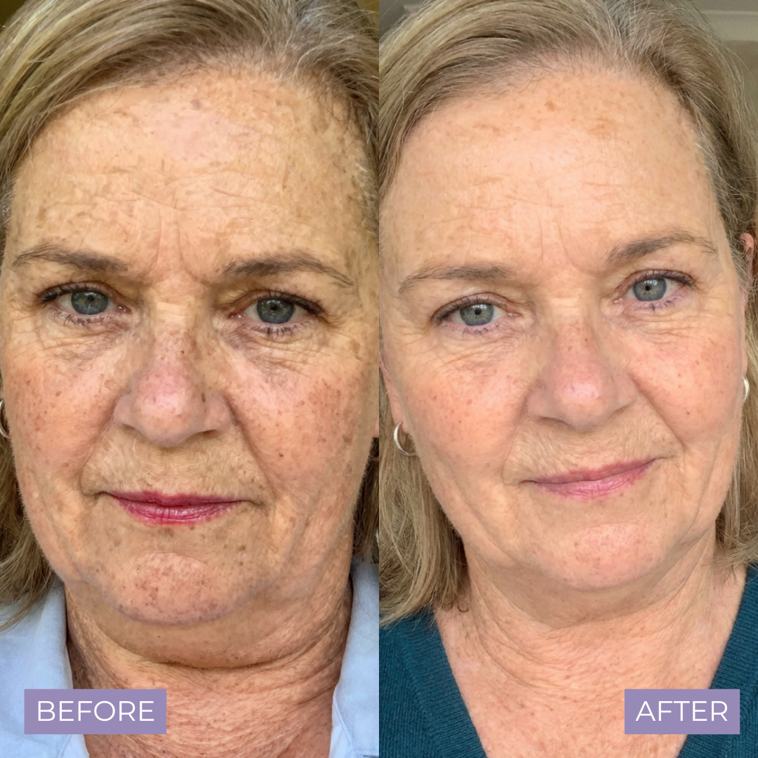 Kelle Brightening Serum