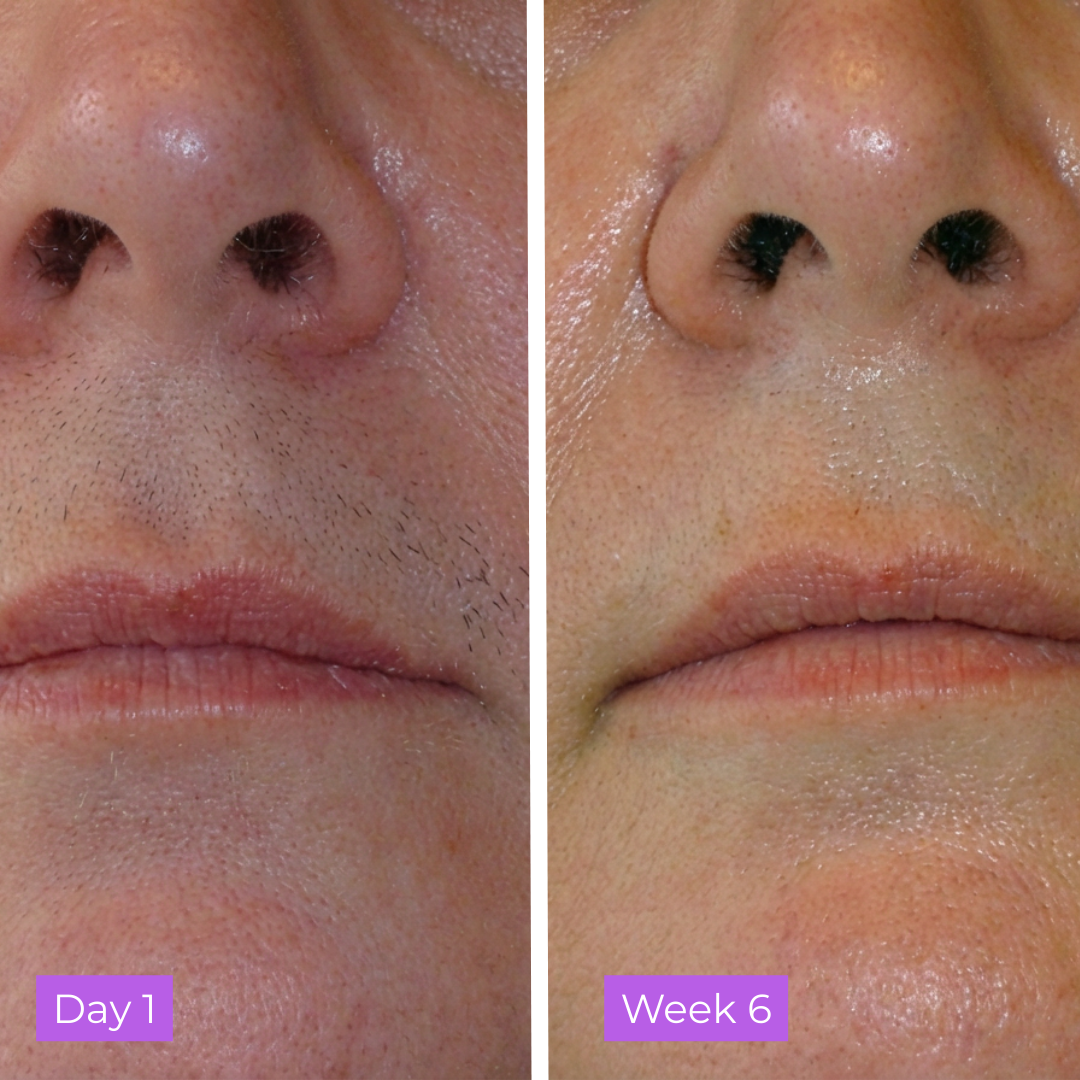 Viareline Skin Serum