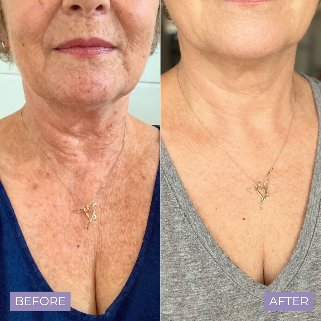 Kelle Brightening Serum