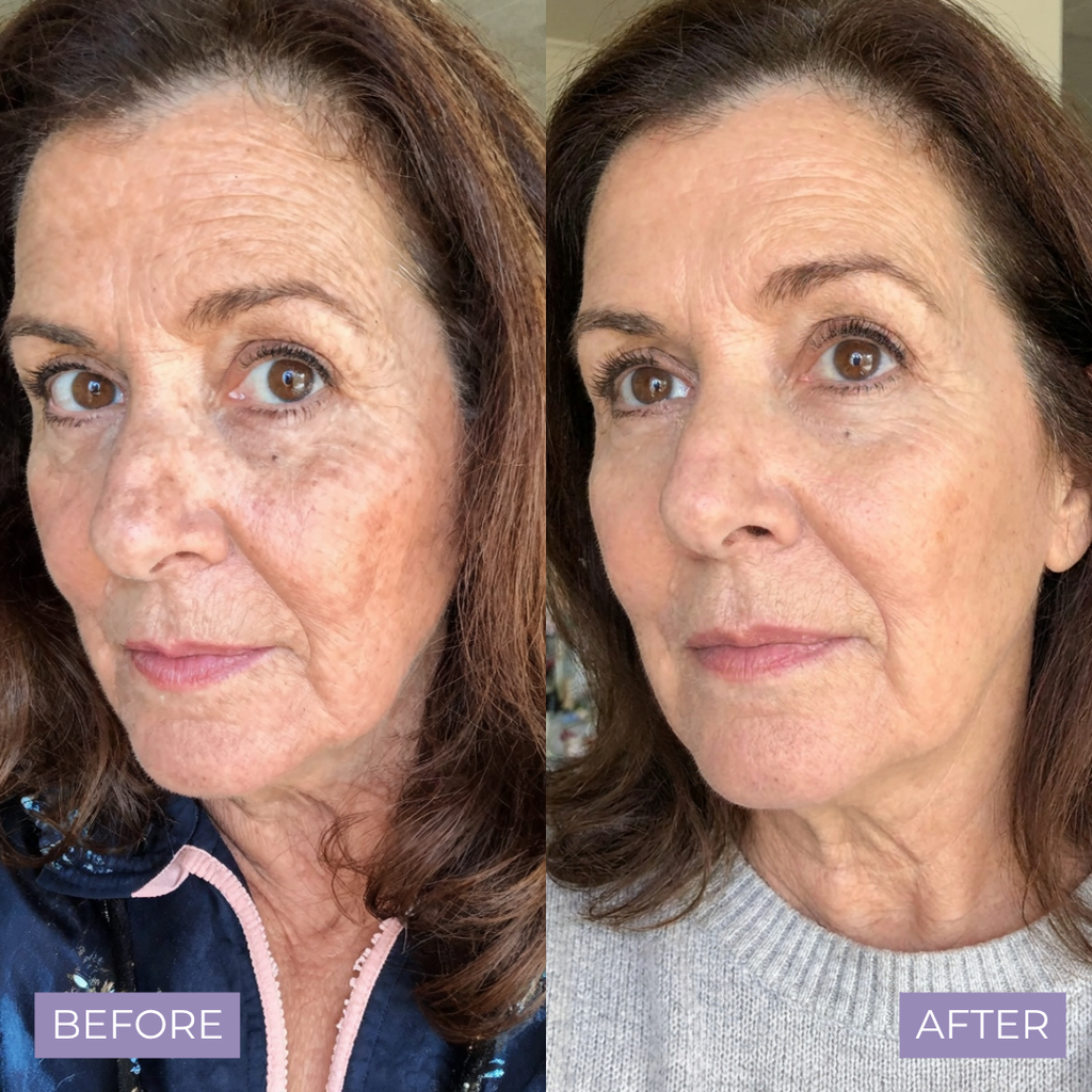 Kelle Brightening Serum