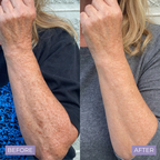 Kelle Brightening Serum