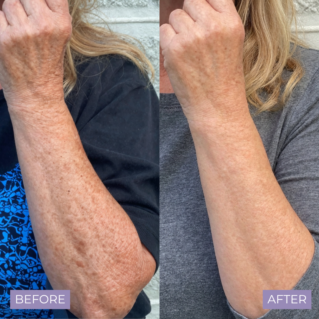 Kelle Brightening Serum