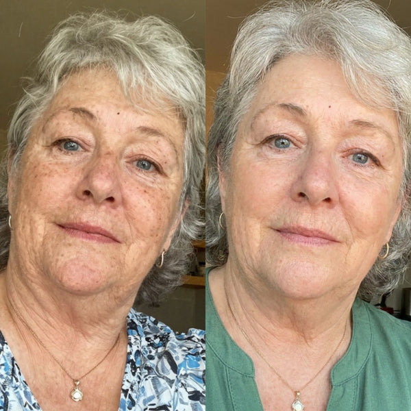Before and after results